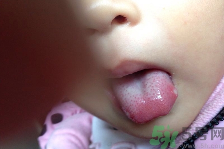 舌頭長泡怎么辦？舌頭長泡的原因？