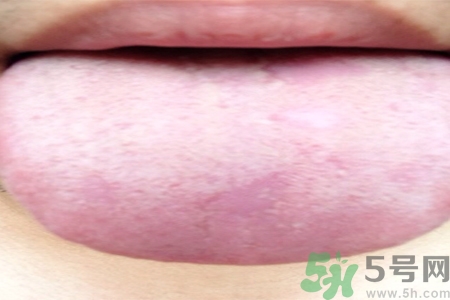 舌頭發(fā)白是什么原因？舌苔發(fā)白是怎么辦？