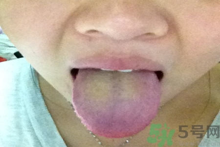 舌苔厚黃是怎么回事？舌頭發(fā)黃怎么辦？