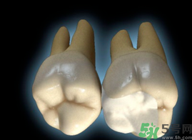 牙齒根管治療多少錢？根管治療一顆要多少錢？