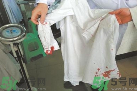 清除衣服上血跡的方法有什么？