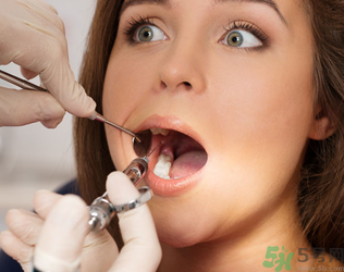 根管治療有什么危害？根管治療的適應(yīng)癥有哪些？