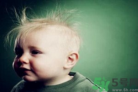 寶寶頭發(fā)少怎么辦？寶寶頭發(fā)少什么原因？
