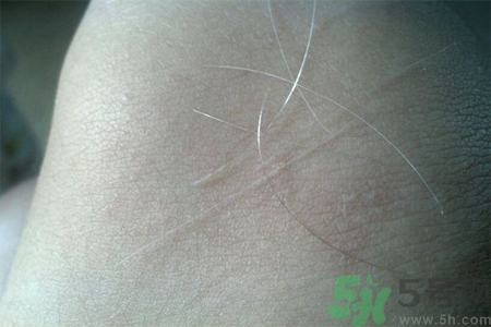 生完寶寶白頭發(fā)的原因？生完寶寶白頭發(fā)怎么辦？