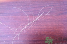 生完寶寶白頭發(fā)的原因？生完寶寶白頭發(fā)怎么辦？