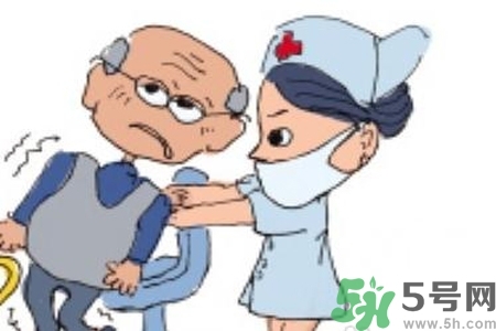 癲癇的典型癥狀有哪些？癲癇是什么？