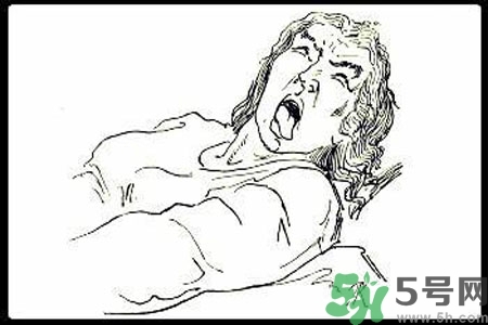 癲癇的護理措施？癲癇的飲食護理是什么？