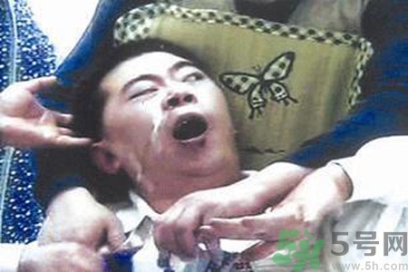 癲癇的發(fā)病因素？癲癇的并發(fā)癥有哪些？