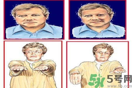 腦中風(fēng)的治療方法？腦中風(fēng)的藥物治療？