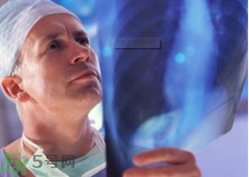 胸透主要檢查什么？男性和女性分別胸透后多久可以要孩子？