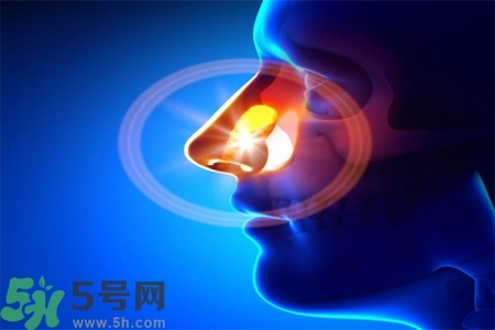 鼻竇炎的高發(fā)人群？如何預(yù)防鼻竇炎？