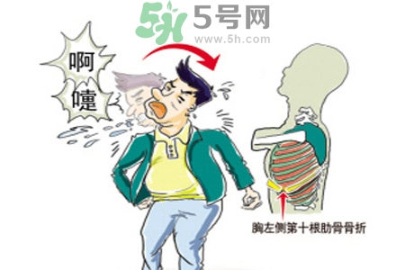 過敏性鼻炎是什么？過敏性鼻炎的癥狀有哪些？