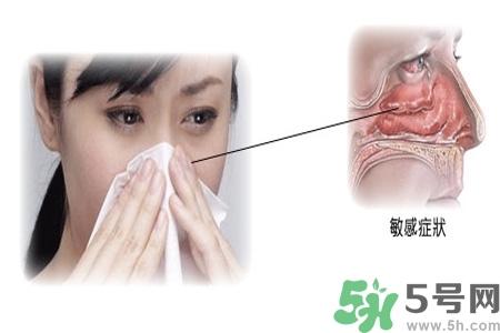 過敏性鼻炎的高發(fā)人群有哪些？如何預(yù)防過敏性鼻炎？