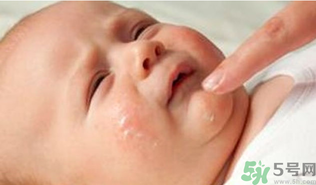 寶寶長(zhǎng)奶蘚怎么回事？寶寶長(zhǎng)奶蘚怎么辦？