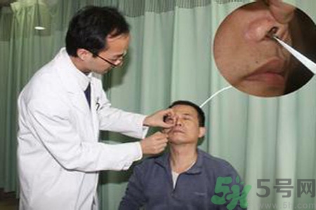 鼻咽癌的治療方法是什么？鼻咽癌可以用什么藥物治療？