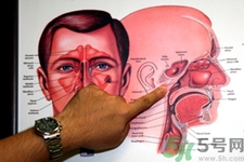 鼻咽癌的發(fā)病因素是什么？鼻咽癌的并發(fā)癥有哪些？