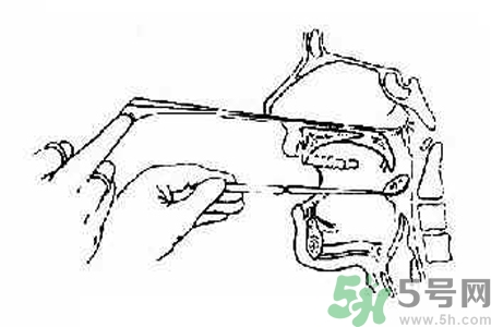 鼻咽癌的高發(fā)人群有哪些？如何預(yù)防鼻咽癌？