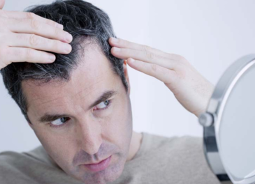 男人禿頂能治好嗎？治療禿頂小偏方