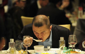 男人禿頂會(huì)遺傳嗎？男人禿頂是腎虛嗎？