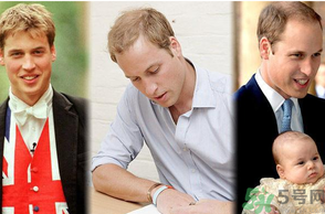 男人禿頂會(huì)遺傳嗎？男人禿頂是腎虛嗎？