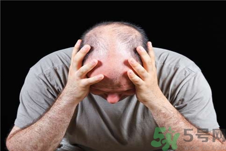 脫發(fā)的高發(fā)人群有哪些？如何預(yù)防脫發(fā)？