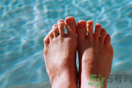 手足癬的治療方法？治療手足癬可以用什么藥？