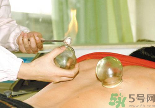 拔火罐和拔氣罐哪個(gè)好？拔火罐和拔氣罐的區(qū)別