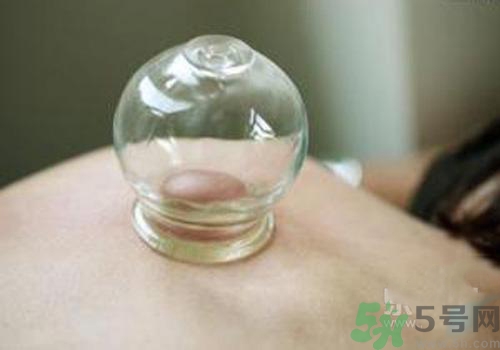 拔火罐和拔氣罐哪個(gè)好？拔火罐和拔氣罐的區(qū)別