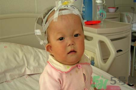 先天性心臟病可以用藥物治療嗎？