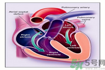 如何預(yù)防心臟??？心臟病的禁忌癥有哪些？