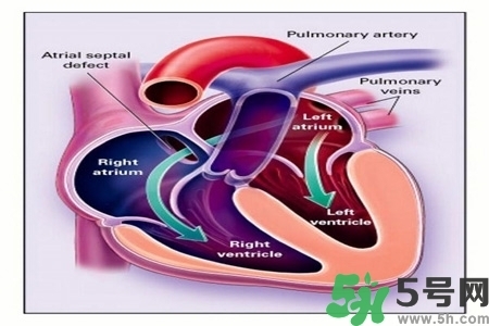 心臟病的癥狀是什么？心臟病的種類有哪些？