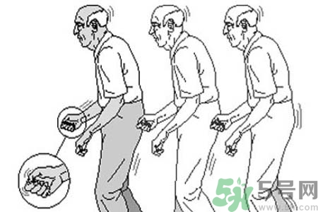 帕金森要注意哪些措施？帕金森的飲食需注意什么？