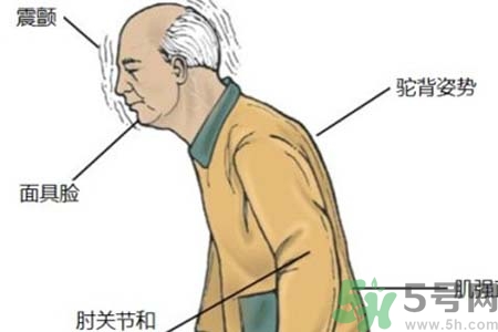 帕金森的易發(fā)人群有哪些？如何預防帕金森？