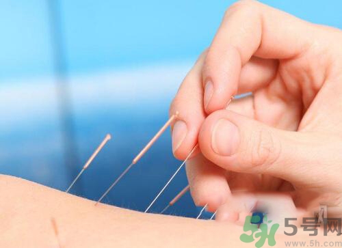 埋線減肥多少錢一次？埋線減肥的副作用