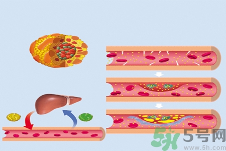 高膽固醇人群該怎么辦？膽固醇高需注意什么？