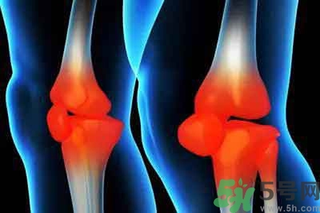 女性預防骨病的方法？女性如何預防骨??？