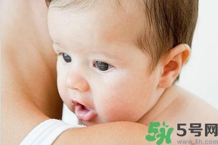 寶寶為什么會感染紅眼??？寶寶患紅眼病如何治療？