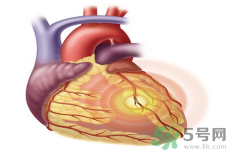 長期酗酒會引起心絞痛嗎？引起心絞痛的原因有哪些？