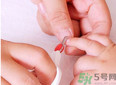 寶寶長(zhǎng)蘚是怎么回事？寶寶長(zhǎng)蘚怎么辦？