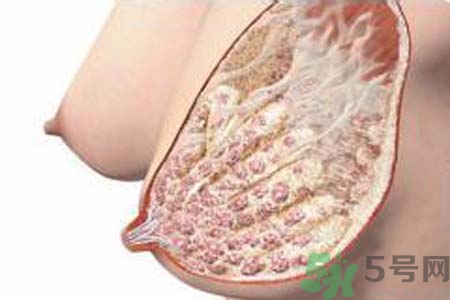 乳房脹痛的原因？乳房脹痛怎么辦？
