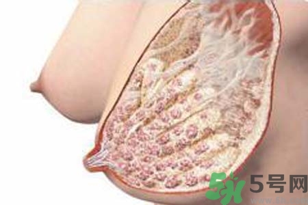乳腺增生治療方法是什么？乳腺增生的檢查方法有哪些？