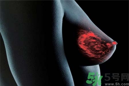 乳腺增生治療方法是什么？乳腺增生的檢查方法有哪些？