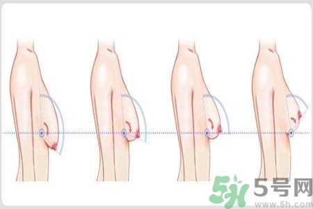 如何預(yù)防胸部松弛？吃什么能使胸部挺拔？