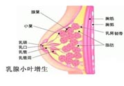 乳腺增生治療方法是什么？乳腺增生的檢查方法有哪些？