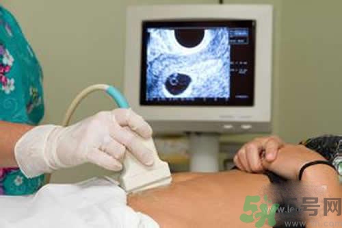 孕婦做b超要空腹嗎？孕婦做b超要不要空腹？