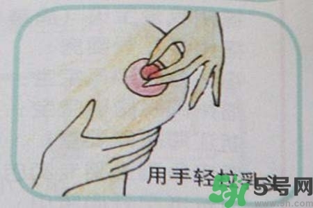 乳頭內(nèi)陷怎么矯正？乳頭內(nèi)陷矯正方法是什么？