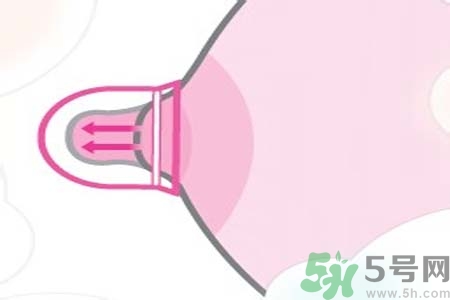 乳頭內陷能不能喂奶？乳頭凹陷怎樣哺乳？