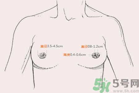 乳頭內陷能不能喂奶？乳頭凹陷怎樣哺乳？