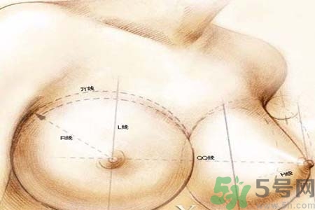 乳頭內陷可以用吸奶器嗎？乳頭內陷能不能用吸奶器？