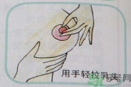 乳頭內(nèi)陷可以拔罐嗎？乳頭內(nèi)陷需要手術(shù)治療嗎？